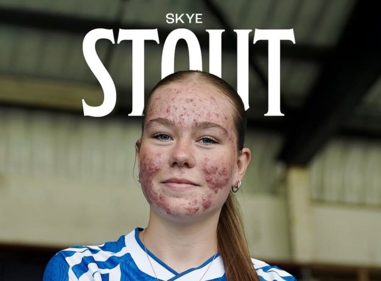 Skye Stout: Η 16χρονη ποδοσφαιρίστρια που απάντησε στο διαδικτυακό μπούλινγκ με ένα υπέροχο γκολ