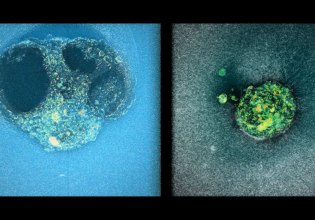 Έρευνα IBEC: 3D απεικόνιση εμφύτευσης ανθρώπινου εμβρύου δίνει ελπίδα για τις θεραπείες γονιμότητας