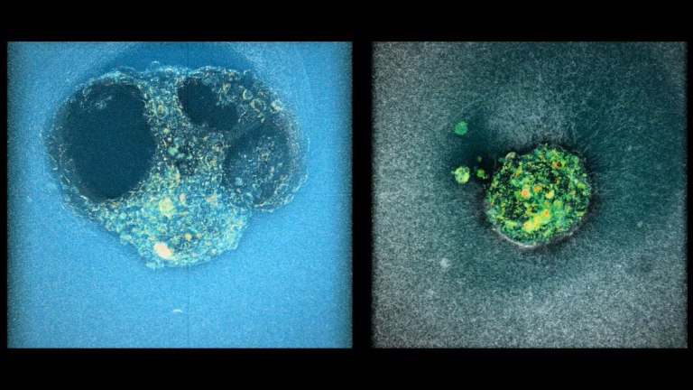 Έρευνα IBEC: 3D απεικόνιση εμφύτευσης ανθρώπινου εμβρύου δίνει ελπίδα για τις θεραπείες γονιμότητας