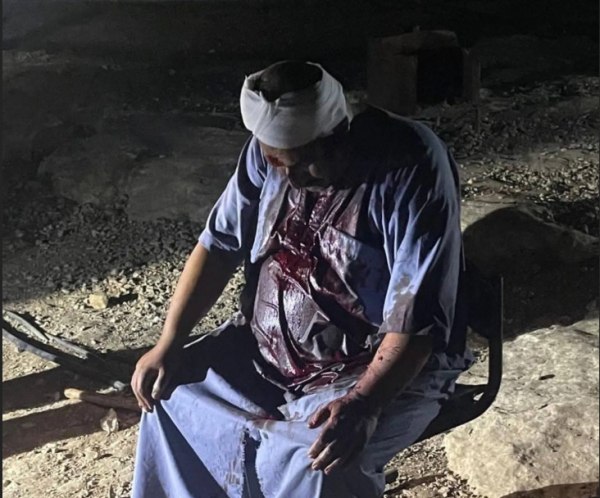 Δυτική Όχθη: Άγριες επιθέσεις εποίκων και στρατού μετά τις δηλώσεις Σμότριχ – Το Ισραήλ συνεχίζει να προκαλεί