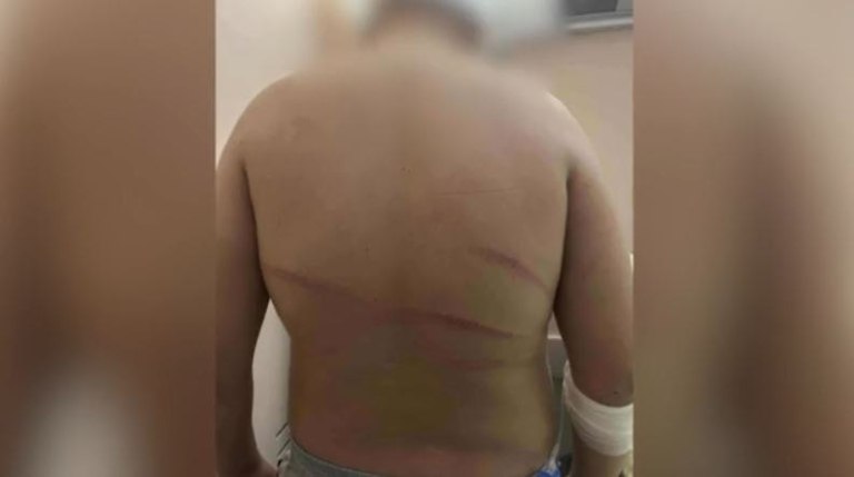 Θεσσαλονίκη: Για απόπειρα ανθρωποκτονίας διώκεται ο 18χρονος που συνελήφθη για τον ξυλοδαρμό 13χρονου