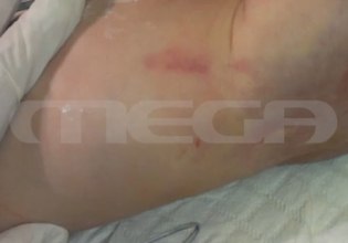 Αποκαλύψεις για το 2,5 ετών βρέφος που πέθανε από κακοποίηση – Τι υποστήριζε τότε ο ιατροδικαστής