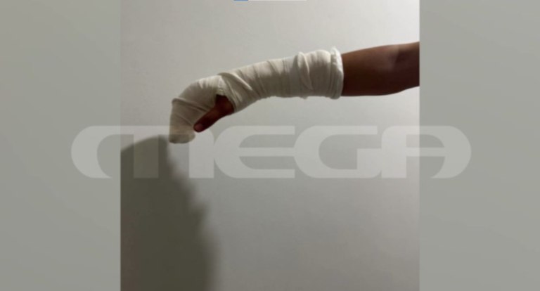 Κυψέλη: «Του διέλυσαν τον τένοντα» – Σοκάρουν οι περιγραφές της μητέρας του 17χρονου που ξυλοκοπήθηκε μέσα στο σχολείο