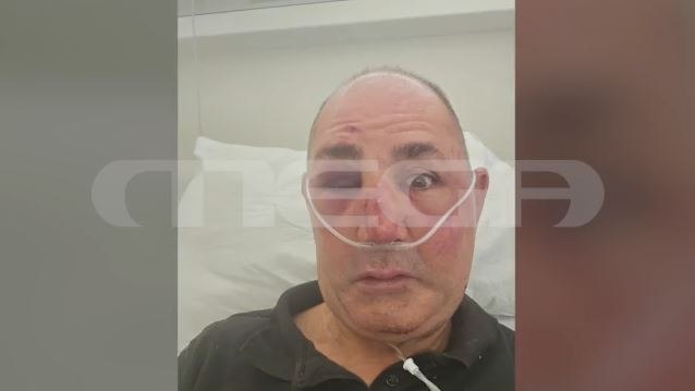 Ρόδος: Σοκάρουν οι εικόνες από την άγρια επίθεση σε κοσμηματοπώλη – «Έλεγα ότι θα πεθάνω»