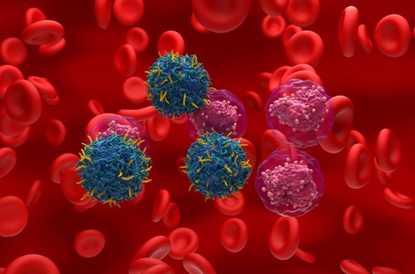 Λέμφωμα: Τα θετικά αποτελέσματα με θεραπείες CAR-T επεκτείνουν την έρευνα