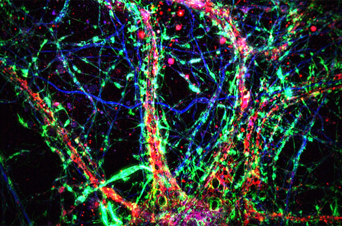 Οι νανοσωληνίσκοι διακρίνονται ως λεπτές πράσινες γραμμές ανάμεσα σε νευρώνες ποντικού (Minhyeok Chang et al.)