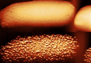 Εντυπωσιακές εικόνες δείχνουν πώς ένα αντιβιοτικό διαλύει τα βακτήρια