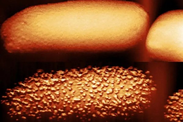 Εντυπωσιακές εικόνες δείχνουν πώς ένα αντιβιοτικό διαλύει τα βακτήρια