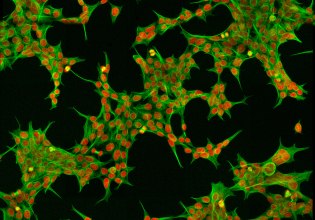 Αρωματοποιοί δημιούργησαν κύτταρα με αίσθηση της όσφρησης