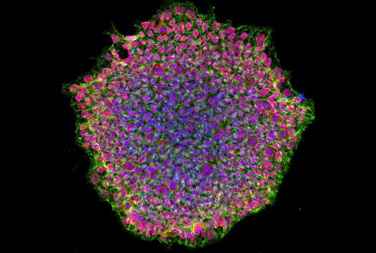 Επαγόμενο βλαστοκύταρο που δημιουργήθηκε στο εργαστήριο από ενήλικα κύτταρα (ΝΙΗ)