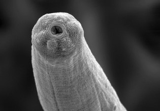 Βίντεο: Παράσιτο εκμεταλλεύεται τον στατικό ηλεκτρισμό για να πηδά στα θύματά του σαν πύραυλος