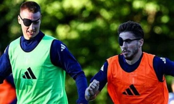 Προπόνηση με το ένα μάτι κλειστό: Η ιδιαίτερη… μέθοδος του Μπαλντίνι στην Ιταλία Κ21 (pic)