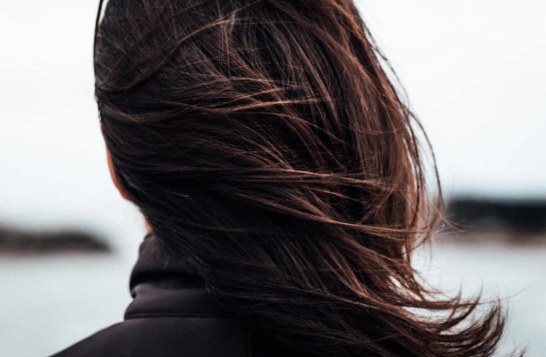 Καινούρια μαλλιά μετά από μεταμόσχευση με βλαστοκύτταρα – «παραφυάδες»