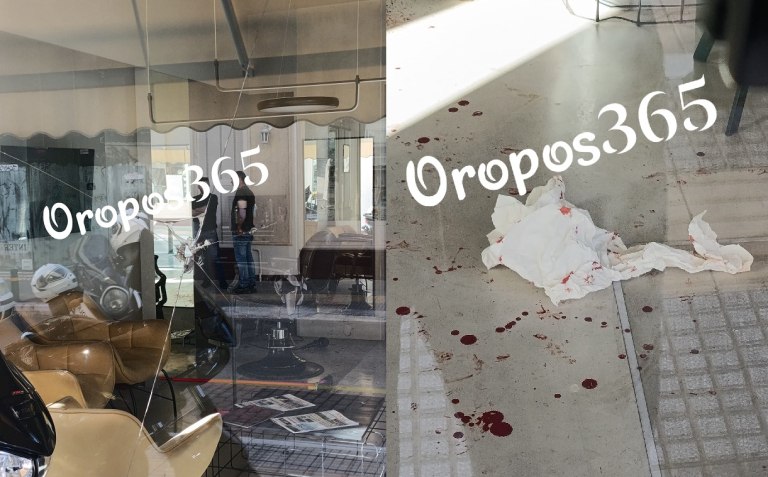 Ωρωπός: Άγρια επίθεση σε κομμωτήριο γεμάτο κόσμο – Στο νοσοκομείο ο 28χρονος ιδιοκτήτης