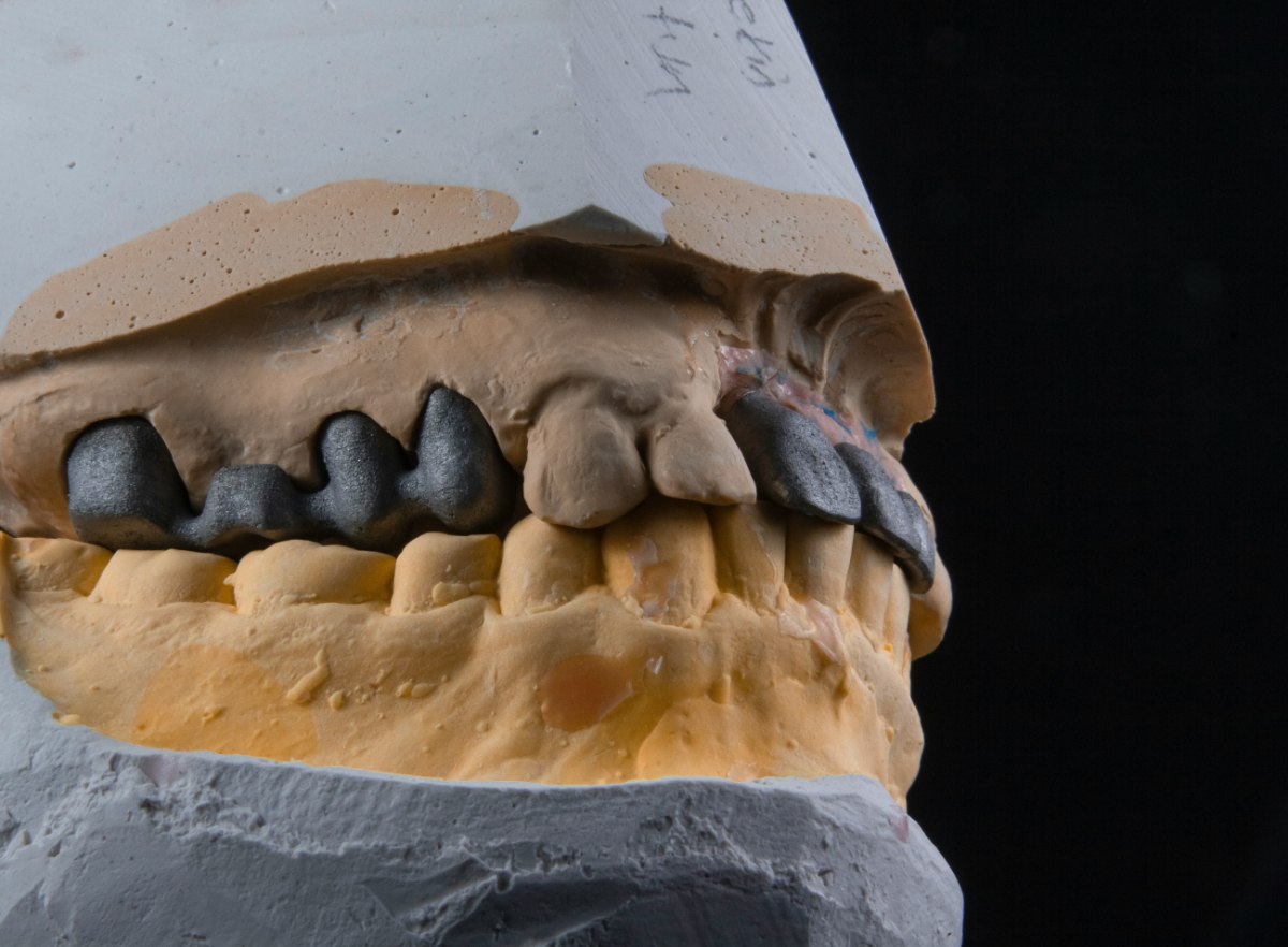 Τα δόντια των πρώτων αγροτών της Συρίας «μιλούν»: Πώς οι γυναίκες ένωσαν τα πρώτα χωριά του κόσμου