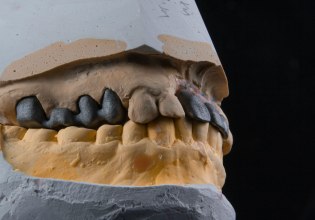 Τα δόντια των πρώτων αγροτών της Συρίας «μιλούν»: Πώς οι γυναίκες ένωσαν τα πρώτα χωριά του κόσμου