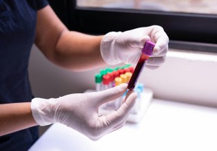 «Ολιστική» εξέταση αίματος ανιχνεύει 59 ασθένειες – Από λοιμώξεις μέχρι καρκίνους