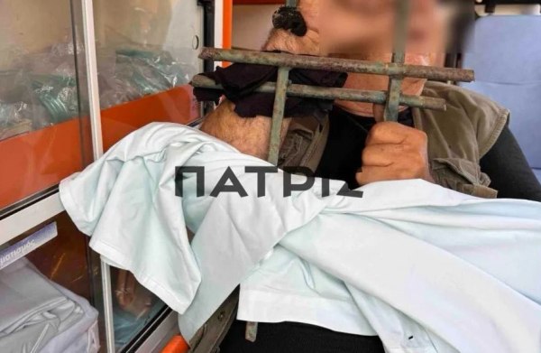 Κρήτη: Σοκαριστική φωτογραφία – Σίδερο περίφραξης καρφώθηκε στο χέρι 64χρονου