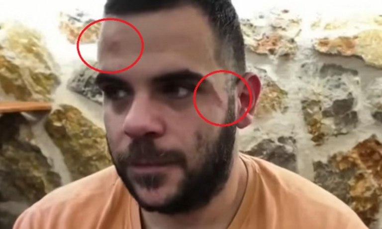 Ξυλοκόπησαν Youtuber σε live μετάδοση στα Γιάννενα