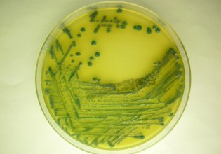 Μείωση 40% των νοσοκομειακών λοιμώξεων απέτρεψε 17.000 μέρες νοσηλείας επιπλοκών