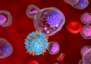 Θεραπεία σε σοβαρά λεμφώματα φέρνουν οι κυτταρικές θεραπείες CAR-Τ στο 60% των ασθενών