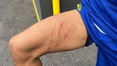 Άρης: Το σημάδι στο πόδι του Ρόουζ από το μαρκάρισμα του Ιβανούσετς (pic)
