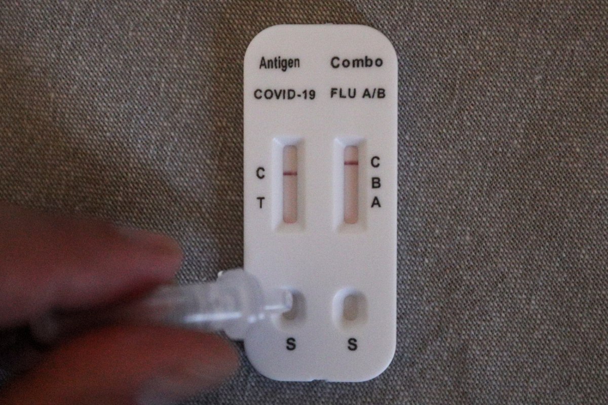 ΕΟΔΥ: Σε υψηλά επίπεδα η γρίπη – Αυξήθηκαν οι εισαγωγές σε νοσοκομεία και οι νοσηλείες σε ΜΕΘ