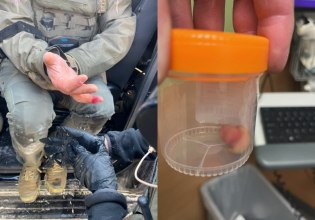 Μινεάπολη: Διαδηλωτές κατηγορούνται πως επιτέθηκαν σε πράκτορα του δάγκωσαν και του έκοψαν το δάχτυλο