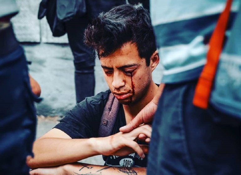 Χιλή: Αθώωσαν τον αστυνομικό που πυροβόλησε και τύφλωσε διαδηλωτή στις μεγάλες κινητοποιήσεις το 2019