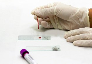 Τεστ αίματος ανιχνεύει τη νόσο του Crohn χρόνια πριν από την εμφάνιση συμπτωμάτων