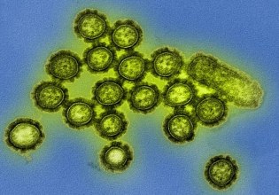 Γρίπη D και κορονοϊός των σκύλων – Νέοι αναδυόμενοι ιοί αναγνωρίστηκαν ως απειλή για τη δημόσια υγεία