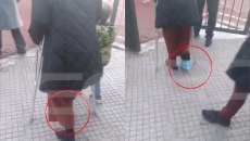 Ζωγράφου: Υποχρέωσαν νηπιαγωγό να γυρίσει στο σχολείο με σπασμένο πόδι – «Ζητάω ίσα δικαιώματα»