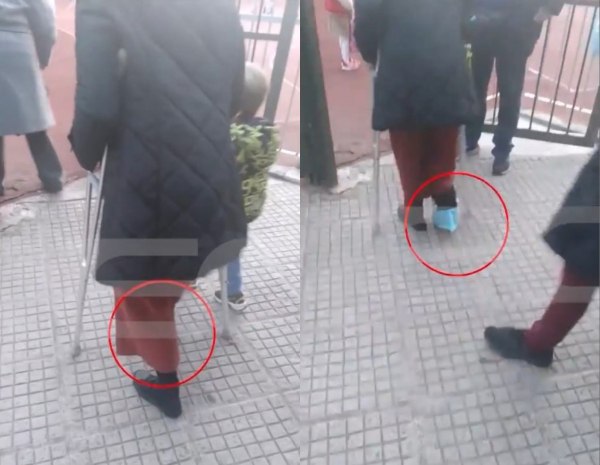 Ζωγράφου: Υποχρέωσαν νηπιαγωγό να γυρίσει στο σχολείο με σπασμένο πόδι – «Ζητάω ίσα δικαιώματα»