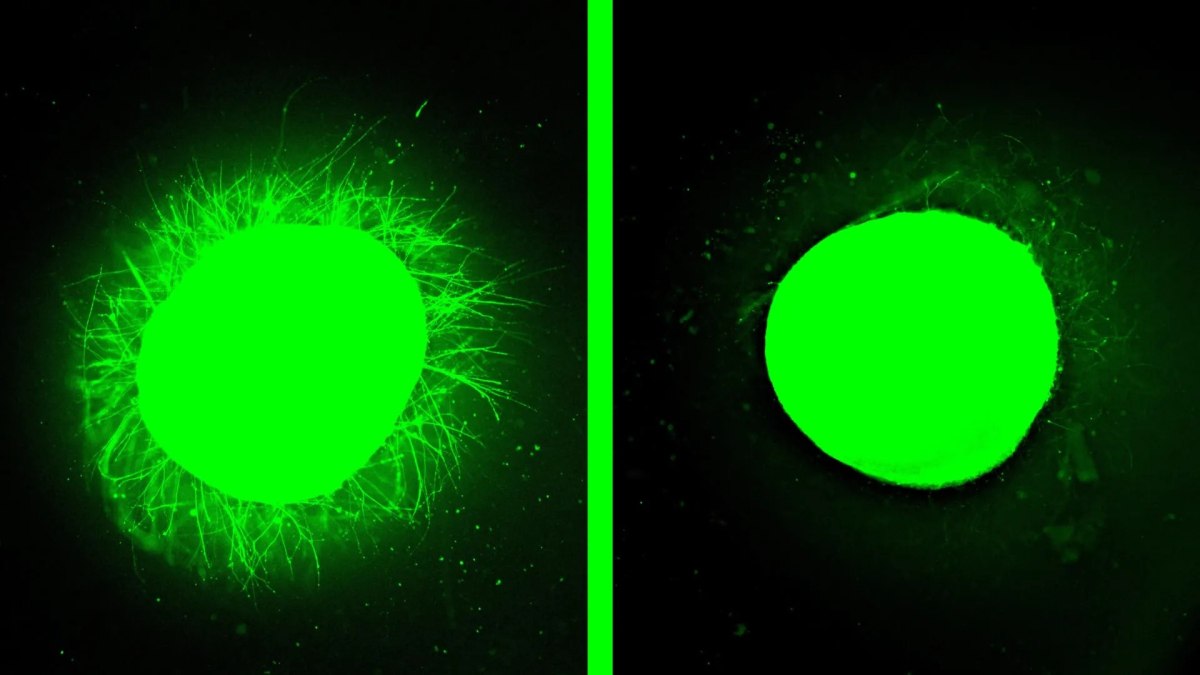 Σε αυτές τις φθορίζουσες εικόνες εμφανίζεται αυξημένη ανάπτυξη νευριτών σε ένα ανθρώπινο οργανοειδές νωτιαίου μυελού στο οποίο έχει γίνει έγχυση μορίων που χορεύουν (αριστερά). Στη δεξιά εικόνα όπου έχει γίνει έγχυση μορίων που κινούνται αργά δεν παρατηρείται το ίδιο θετικό αποτέλεσμα (Samuel I. Stupp/Northwestern University