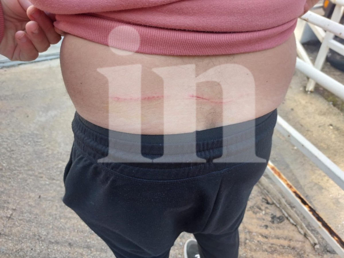 Επίθεση λύκου στο Τατόι: Στο in ο άνδρας που του επιτέθηκε το άγριο ζώο