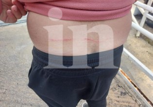 Επίθεση λύκου στο Τατόι: Στο in ο άνδρας που του επιτέθηκε το άγριο ζώο