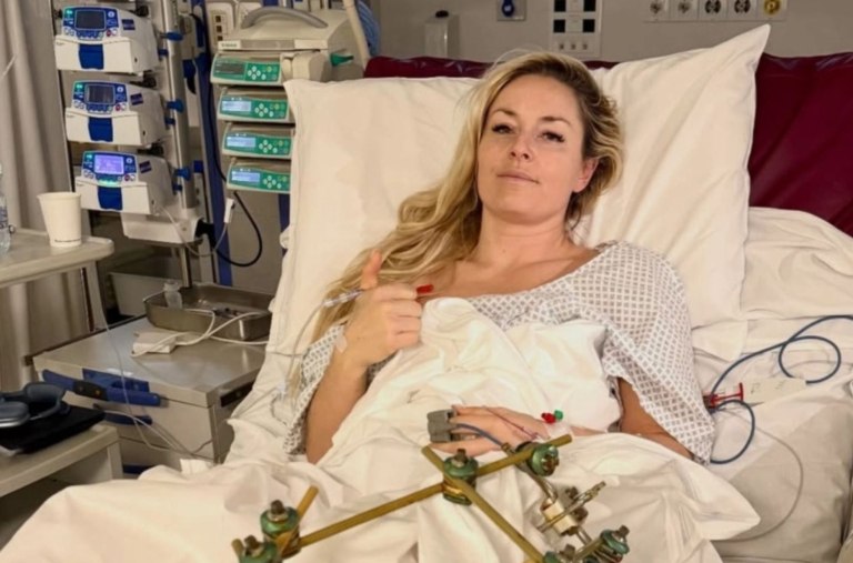 Το μήνυμα της Λίντσεϊ Βον πριν τα επόμενα χειρουργεία: «Η αγάπη του κόσμου μου δίνει δύναμη» (vid)