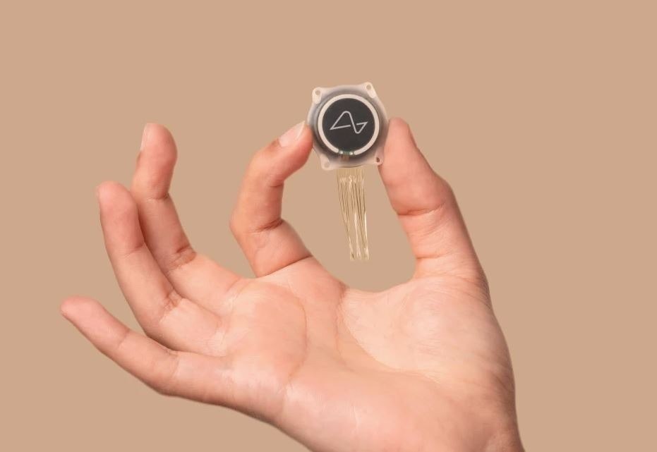 To τσιπ «Telepathy» της Neuralink είναι πιο επεμβατικό, καθώς ράβεται απευθείας στον εγκέφαλο (Neuralink)