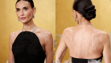 «Παλιά σου έλεγαν ότι είσαι παχιά, τώρα σου λένε ότι έχεις φλεγμονή» – Το skinny ως δείγμα υγείας