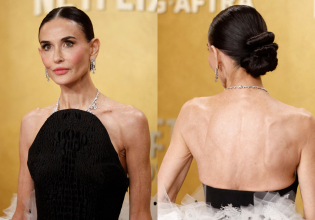 «Παλιά σου έλεγαν ότι είσαι παχιά, τώρα σου λένε ότι έχεις φλεγμονή» – Το skinny ως δείγμα υγείας