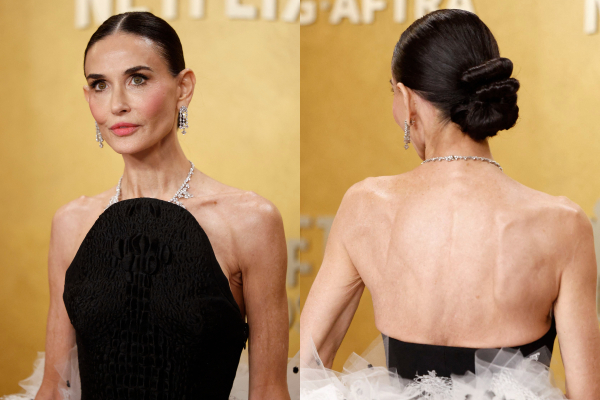 «Παλιά σου έλεγαν ότι είσαι παχιά, τώρα σου λένε ότι έχεις φλεγμονή» – Το skinny ως δείγμα υγείας