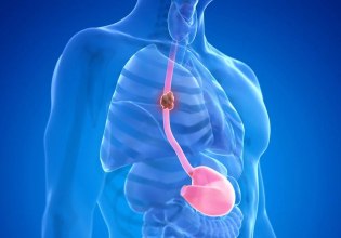 Συνθετικό μόσχευμα δίνει ελπίδα για παιδιά που γεννιούνται χωρίς οισοφάγο