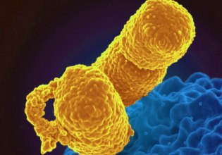 Τριπλάσια πλέον στην Ελλάδα τα 3 μικρόβια που κανένα αντιβιοτικό δεν σταματά