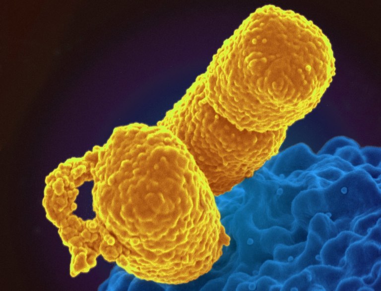 Τριπλάσια πλέον στην Ελλάδα τα 3 μικρόβια που κανένα αντιβιοτικό δεν σταματά