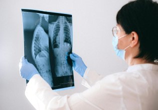 Ακτινολόγοι προειδοποιούν για πιθανές απάτες με deepfake ακτινογραφίες