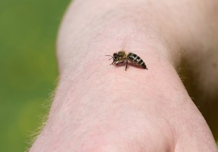 Πότε ένα τσίμπημα μπορεί να οδηγήσει στο θάνατο – Τι είναι το αλλεργικό σοκ και τι πρέπει να προσέξετε