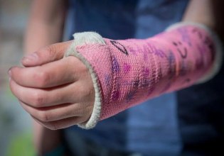 Τα υπερεπεξεργασμένα τρόφιμα «εχθρός» των οστών μας