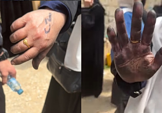 Οι ισραηλινές δυνάμεις «σφραγίζουν» τα χέρια Παλαιστίνιων γυναικών