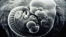 Ένα γράμμα του DNA αρκεί για να μετατρέψει θηλυκά έμβρυα σε αρσενικά