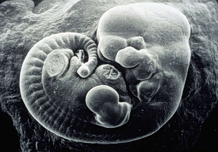 Ένα γράμμα του DNA αρκεί για να μετατρέψει θηλυκά έμβρυα σε αρσενικά